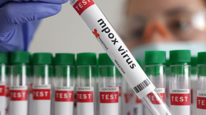 First case of new mpox variant identified in Germany