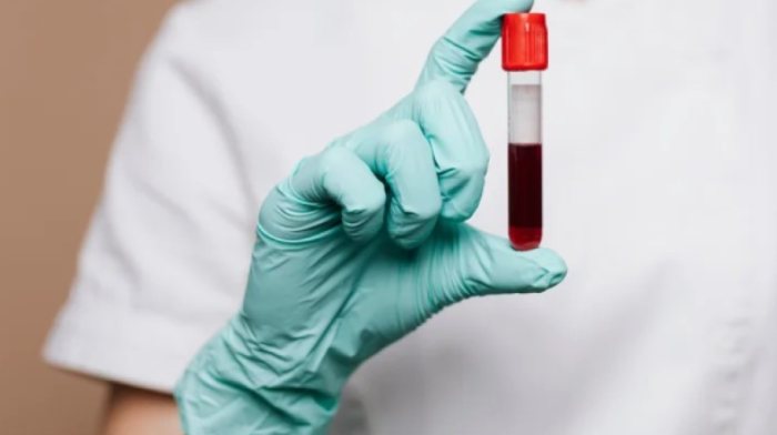 Revolutionary AI-powered blood test for cancer enters NHS trials