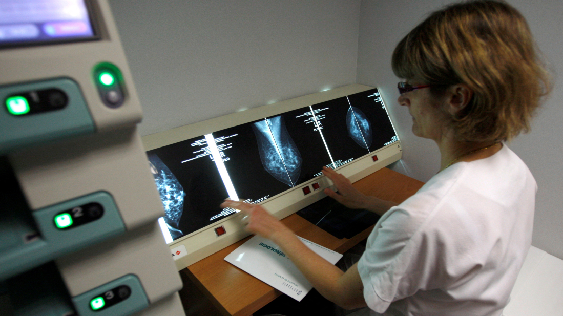 Brain tumor diagnosis in hours: faster surgery and treatment