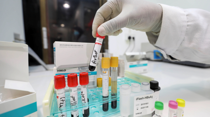 Early Alzheimer's diagnosis is now closer than ever