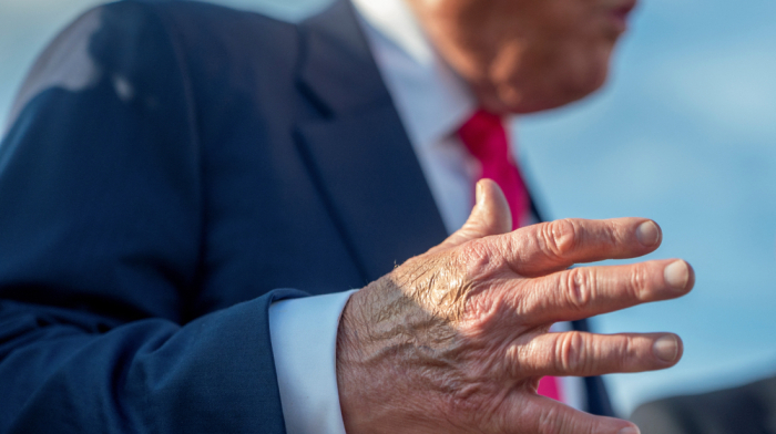 White House says Trump diagnosed with chronic vein condition