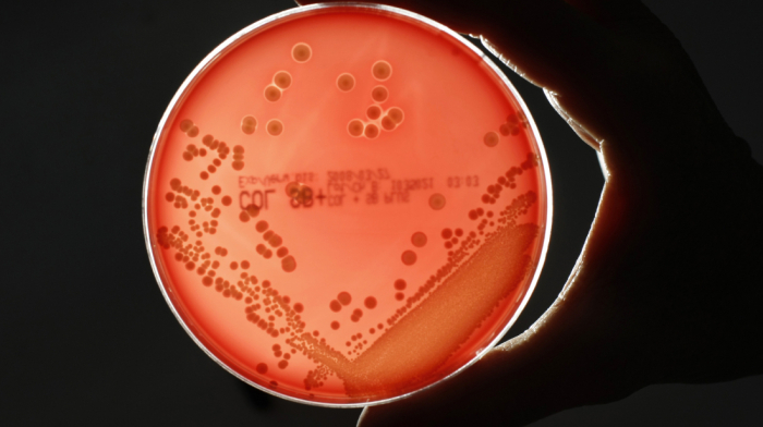 Superbugs could cause millions of deaths and nearly $2 trillion in global losses by 2050