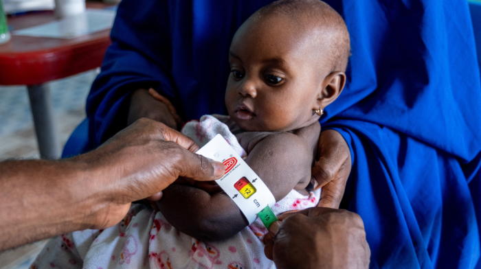 At least 652 children die from malnutrition in Nigeria’s Katsina state