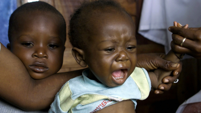 UN says 80,000 children face cholera risk in West and Central Africa