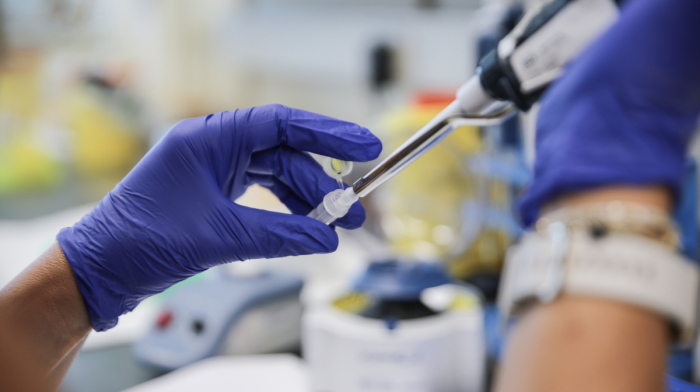 Mpox virus cases on the rise in Portugal with 29 people infected