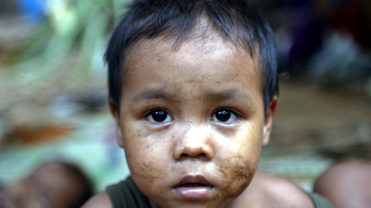 417 million children face severe deprivation worldwide, UNICEF warns