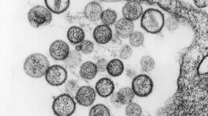 Hantavirus explained: What WHO says about the rare but deadly virus