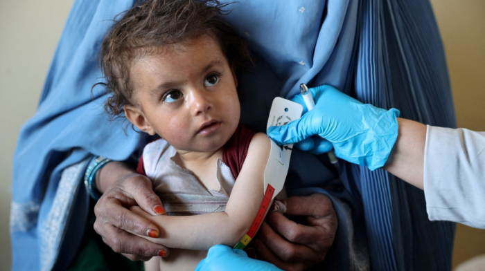 UNICEF warns 3.7 million Afghan children face rising malnutrition risk
