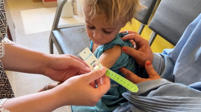 UNICEF warns 3.7 million Afghan children are acutely malnourished as services shrink