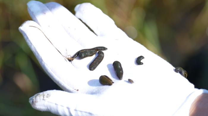Leeches: The ancient remedy Azerbaijan hopes to take global